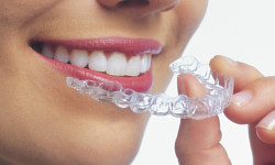 invisalign